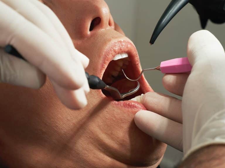 Sanovnik zubar – Šta znači sanjati zubara?